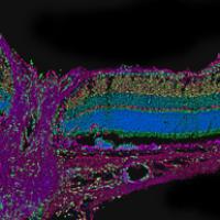 Cross section of retina and optic nerve