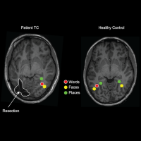 fMRI brain scan shows activity in two different brains