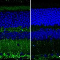 Fluorescent images of mouse retinal layers