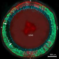 Microscopy image of lens and zone fibers stained red, blue and green.