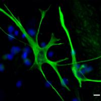 Fluorescent green cell with long projections