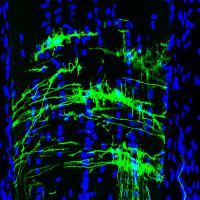 Microscopy image in blue and green showing mouse optic nerve