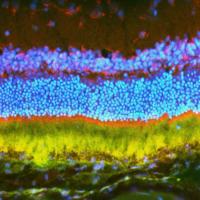 Multicolor image of retina in cross-section