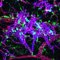 Colorful confocal image of endothelial cells and microglia