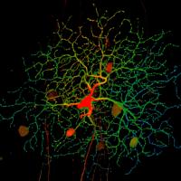 Retinal ganglion cell with a red cell body and green axons spread out over a large area