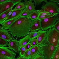 Human iPSC-derived retinal pigment epithelium (RPE). 