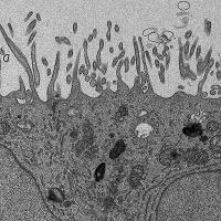 Grey scale electron microscopy image of human retinal cells.
