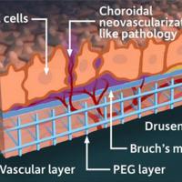 Retina model shows RPE cells, choroidal neovascularization-like pathology, vascular layer, PEG layer, Bruch's membrane, drusen