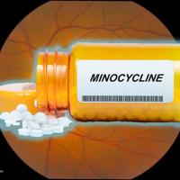 minocycline pill bottle in front of retina photo