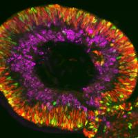 Retina organoids mimic the structure and function of the human retina to serve as a platform to study underlying causes of retinal diseases, test new drug therapies, and provide a source of cells for transplantation. credit: David Gamm, M.D., Ph.D., University of Wisconsin-Madison