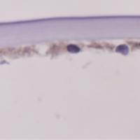 Corneal section from a person with Fuchs dystrophy shows the presence of ATP1B1 in the corneal endothelium.