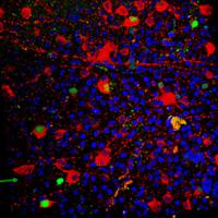 Dr. John Guy and colleagues added a homing signal to a virus in order to deliver the ND4 gene into mitochondria. A marker for the gene is shown in red and the ND4 protein is shown in green, inside retinal ganglion cells in the mouse eye. The nuclei of retinal ganglion cells are shown in blue. Credit: Dr. Hong Yu, Bascom Palmer.