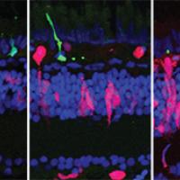 Sequence of five images, spanning 28 days, shows how regeneration happens in the zebrafish retina.  Rods are shown in green, regenerating cells are shown in red, and all other cells are labeled with blue.  As the rods die, regenerating cells increase and replace the lost rods.