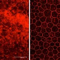 Degenerated RPE cells from mice with geographic atrophy are shown at left. Treating the mice with NRTIs protected the RPE cells. Photos courtesy of Jayakrishna Ambati, M.D.