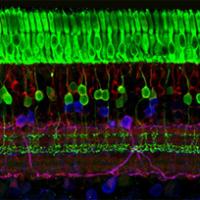 The retina has several layers of nerve cells. Photoreceptors (top, in green) are responsible for detecting light and converting it into electrical signals. Image courtesy of Wei Li, Ph.D., Unit on Retinal Neurophysiology, National Eye Institute.