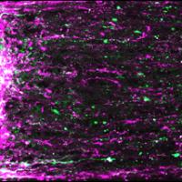 Regenerating mouse retinal ganglion cell axons (magenta and green) extending from site of optic nerve injury (left). Photo courtesy of Andrew D. Huberman.