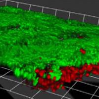 The researchers developed a technique to study live cells in patches of retina, shown here by confocal microscopy. After 2 hours, the vast majority of the cells are alive (green); only a few cells at the perimeter have died (stained red with a dye).