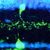 Object motion and amacrine cells in retina