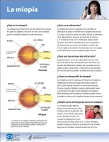 La Miopía (Nearsightedness) thumbnail